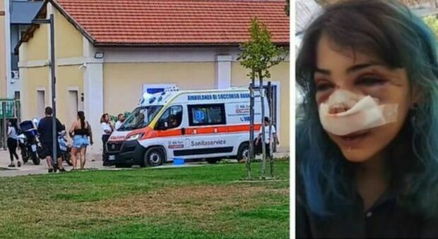 Aggressione al Parco Rossani, indagati l'addetta ai bagni e il compagno: picchiata una 26enne