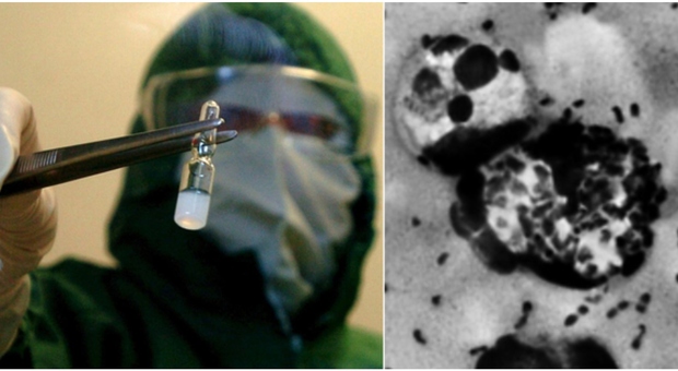 https://statics.cedscdn.it/photos/MED/2026/10/11/9818019_11090013_peste_siberia_usa_casi_piu_frequenti_oggi_si_cura_antibiotici_yersinia_pestis_vive_animali_topi_ratti_oggi.jpg