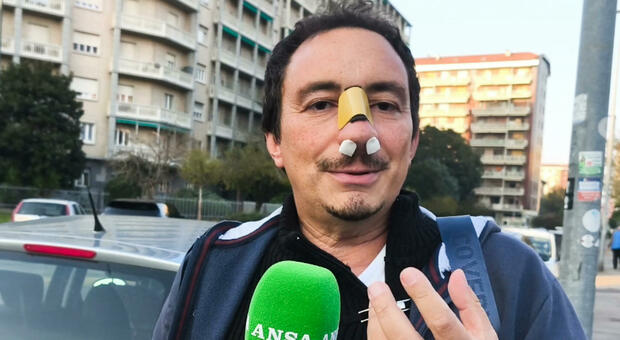 Torino, studente prende a pugni il prof e gli frattura il naso: Bruno Vadal&agrave; aggredito dopo l'interrogazione. &laquo;Violenza immotivata&raquo;