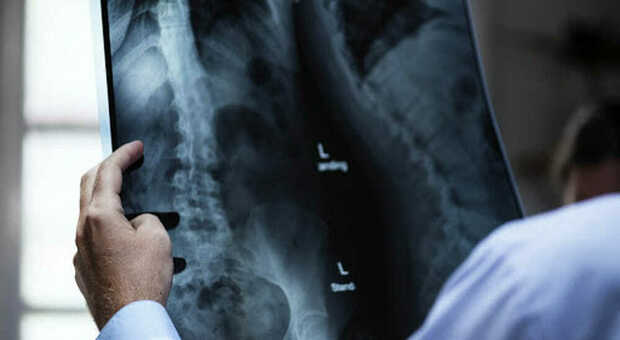 Finte reperibilità nell'ospedale di Sora, chiusa l'inchiesta per cinque tecnici radiologi