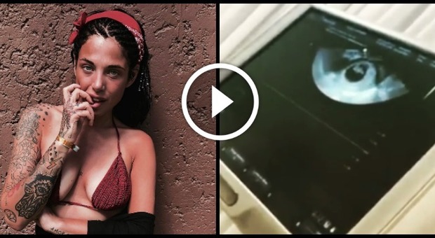 "Ti abbiamo desiderato dal primo giorno": Aurora Betti incinta posta l'ecografia su Instagram