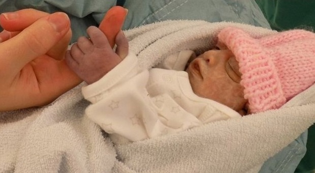 La piccola Hope, morta a 74 minuti dal parto, dona un rene: è la più giovane di sempre