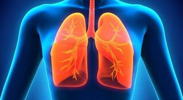 Cancro ai polmoni, con nuovo farmaco cala dell'80% rischio di recidiva o morte