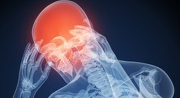 Tutti i segreti del mal di testa: fotografato il cervello durante l'emicrania Lo studio dei ricercatori napoletani