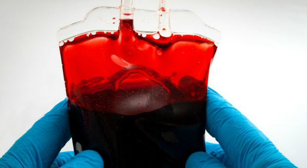 Trasfusione di sangue infetto, donna morì: agli eredi 400mila euro