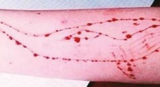 Blue Whale, Elisa ha 13 anni: "Ho fatto il gioco del suicidio"