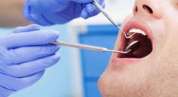 Virus nello studio del dentista, in 22.000 rischiano Hiv ed Epatite
