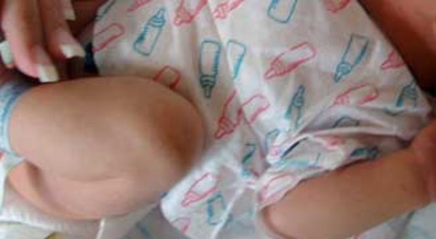Neonato sta morendo di asfissia: congelano il corpicino e lo salvano
