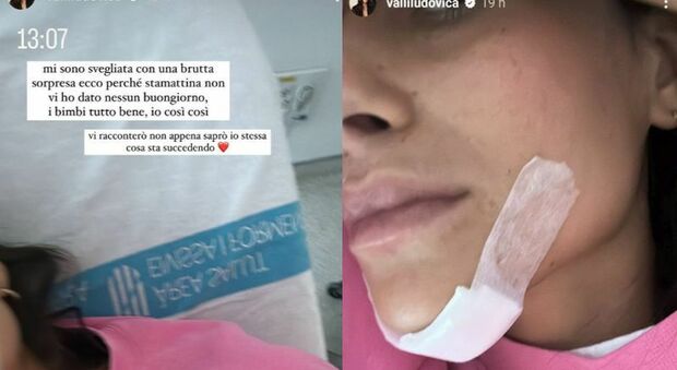 Ludovica Valli in ospedale, follower in allarme: «Mi sono svegliata con una brutta sorpresa»