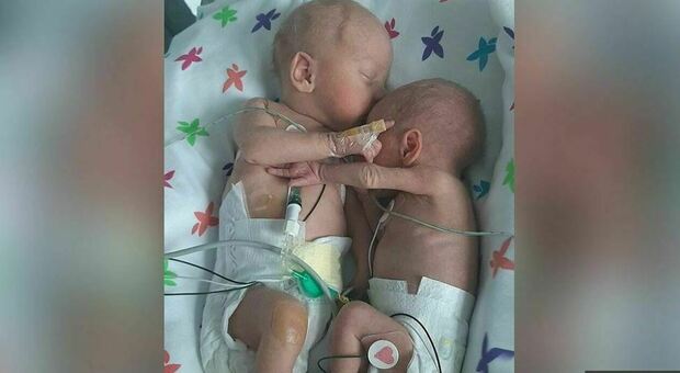 Nella foto i gemellini ricoverati al Liverpool Women's Hospital