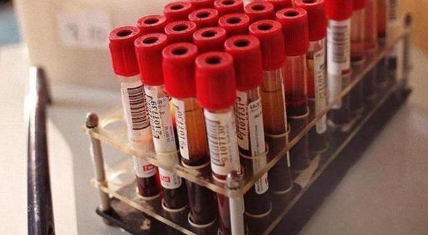 Contrae l'hiv in laboratorio durante la tesi: studentessa fa causa a due atenei