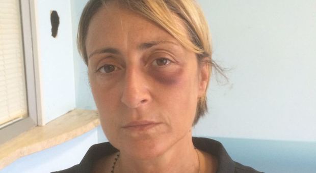 Infermiera del 118 picchiata in ambulanza: «Guardate come mi ha ridotto la paziente»