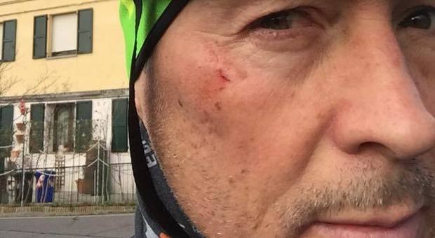 Paolo Belli, incidente in bici: urtato da un'auto, finisce contro il guardrail