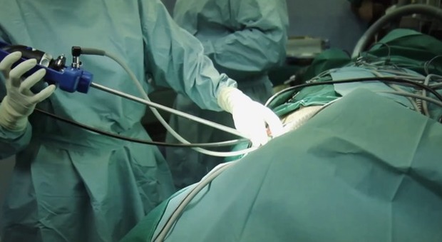Operazione in mondovisione: asportato un tumore con tecnica microinvasiva