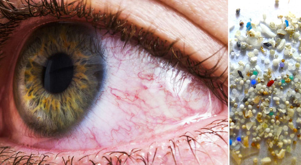 Occhi rossi e gonfi? «Le microplastiche sono anche nei bulbi oculari». L'allarme dei ricercatori Cosa è emerso
