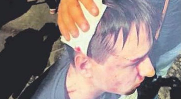 Napoli, la rabbia del 16enne ferito dai calcinacci: «Se mi salvo non tornerò mai più in questa città»