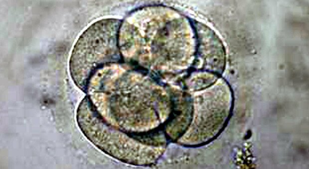 Procreazione assistita: sì all'impianto dell'embrione dell'ex marito, anche se lui non vuole