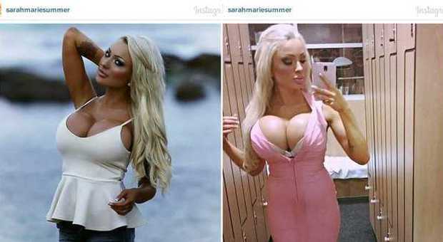 Sarah Marie Summer, il seno diventa oversize (Instagram)