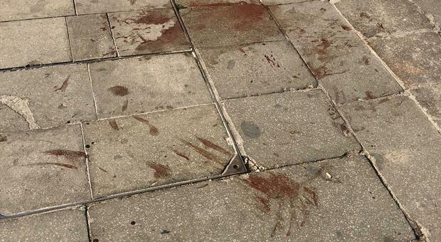 Lite choc a Venezia, picchia a sangue la fidanzata in mezzo ai passanti: grave una 35enne
