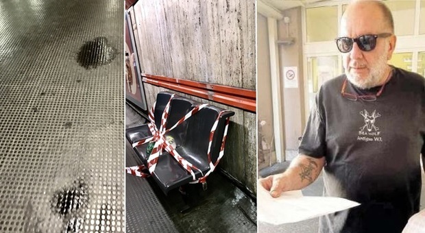 Roma, uomo ustionato dall'acido in metro A e derubato, l'allarme: «Nuova tecnica di rapina, come a Londra»