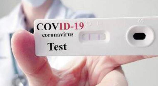 Covid 19, il test che si fa in 6 minuti: «Cambierà la lotta al virus»