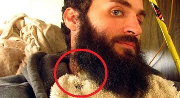 Brian Doss e il suo anatroccolo nella barba (Reddit)