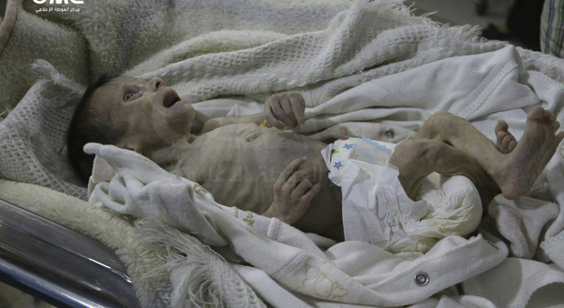 La piccola Sahar muore di fame a un mese di vita: vittima dell'atrocità della guerra in Siria