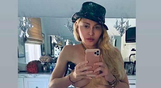 Madonna in topless e con la stampella: la provocazione nasconde un problema più serio