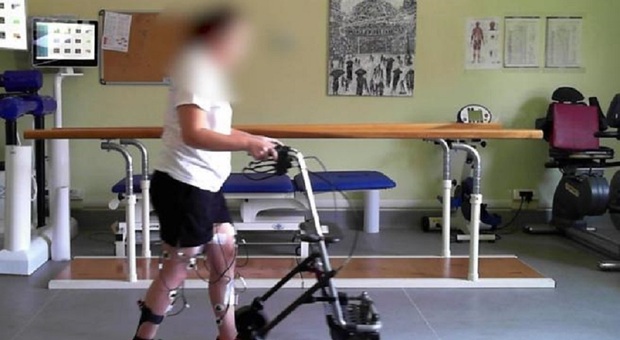 Paralizzata da 5 anni torna a camminare grazie a un neurostimolatore midollare. «È la prima volta in Italia»