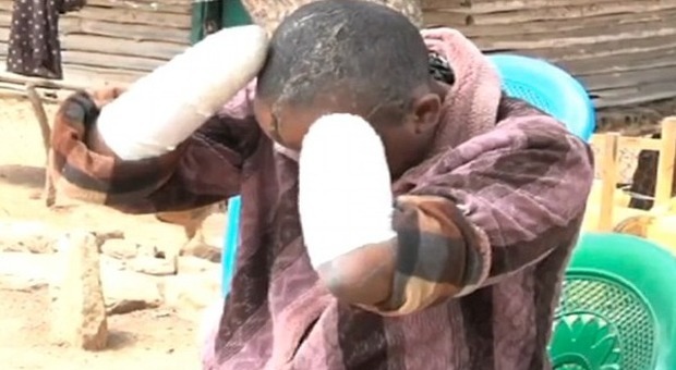 Kenya, la moglie non resta incinta e lui le taglia le mani