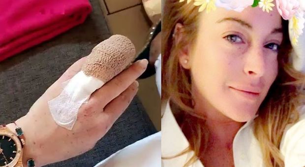 Lindsay Lohan, mezzo dito mozzato: la foto pubblicata sui social