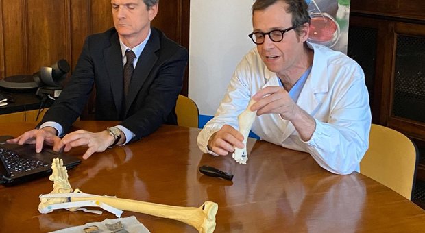 Caviglia ricostruita in 3D all'ospedale Rizzoli di Bologna: «Venti pazienti in lista per il trapianto»