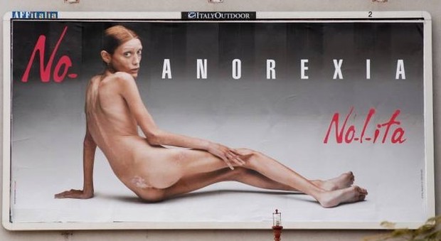 La campagna anti anoressia di Oliviero Toscani