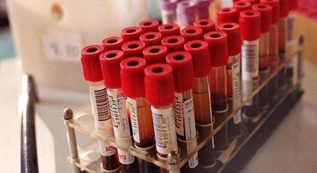 Coronavirus, paziente al Pronto soccorso di Atessa: test negativo