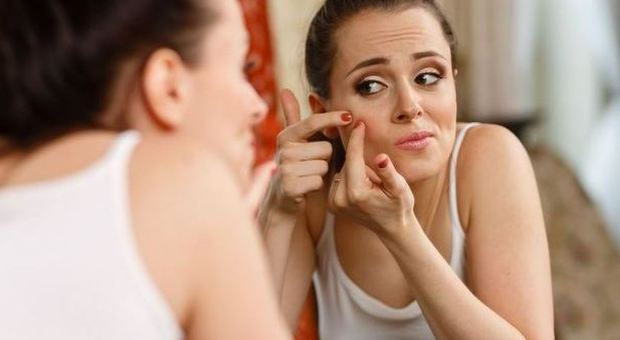 Cinque cose assolutamente impensabili ​che possono provocare l'acne