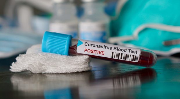 Coronavirus, il primo caso in Europa è stato in Germania: sintomi già il 24 gennaio