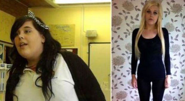 Da obesa a magra, perde 110 kg in due anni ma non è felice: "Rivoglio le mie curve"