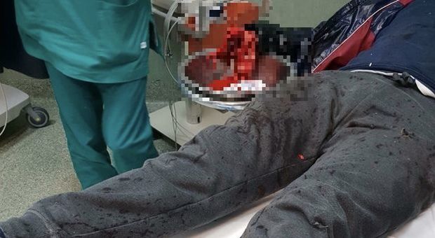 Nel Salernitano 8 feriti per i botti: 35enne perde la mano