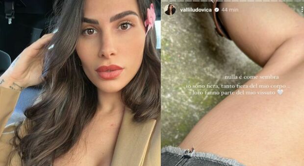 Ludovica Valli mostra le smagliature su Instagram (dopo il secondo figlio): «Sono fiera del mio corpo»