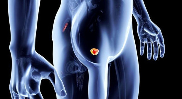 Tumore alla prostata, la nuova terapia che non compromette le funzioni sessuali