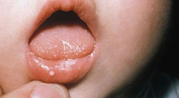 Tagliano la lingua a un bimbo di 7 anni: volevano scacciare il diavolo dal suo corpo