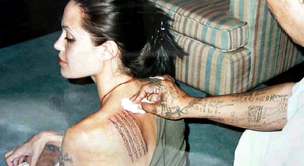 I pentiti dei tatuaggi: con il laser addio a nomi, cuori, date e lucchetti