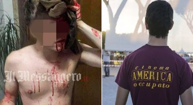 Roma, liceale pestato in strada dal branco: «Levati la maglietta del cinema America, zecca comunista»