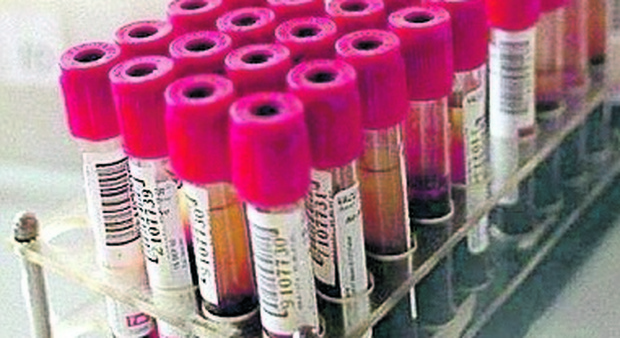 Indagine Istat, al Policlinico di Bari i primi 60 campioni di sangue