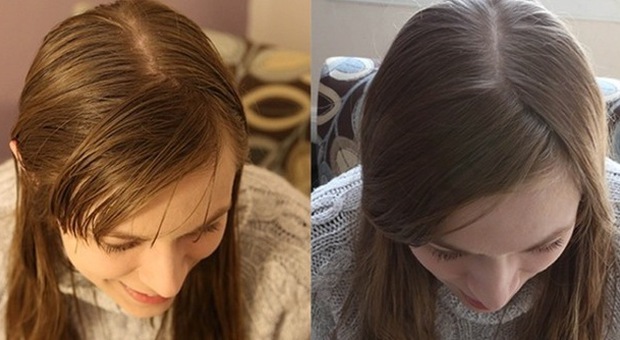 Lava i capelli senza shampoo per 20 giorni: ​il risultato dell'esperimento è sorprendente