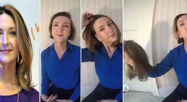Giornalista Bbc si toglie la parrucca in un video per mostrare gli effetti della chemioterapia