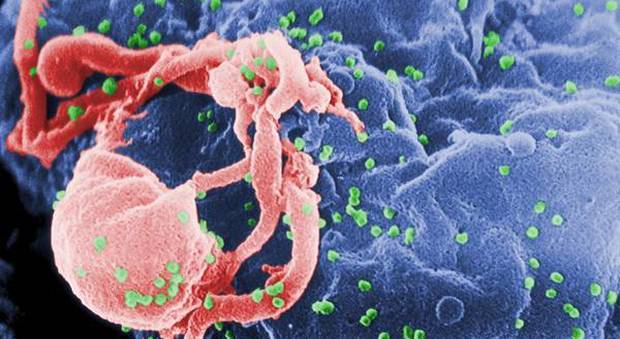 Aids, in Italia 120mila sieropositivi: uno nuovo ogni 2 ore