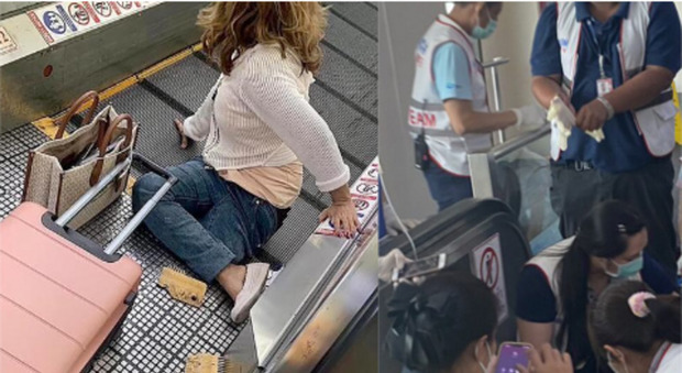 Amputata la gamba di una viaggiatrice: si incastrata nel tapis roulant mentre erain aeroporto a Bangkok. I medici: «Speriamo di salvarla»