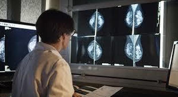 Una dottoressa controlla la mammografia