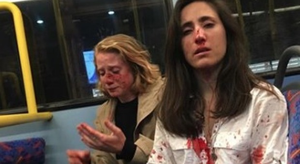 «Lesbiche baciatevi», la coppia di ragazze si rifiuta e viene picchiata e derubata dai bulli sul bus